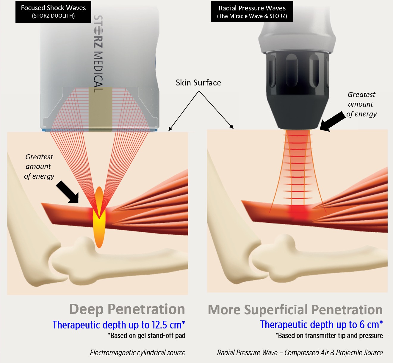 Shockwave Therapy Orange County
